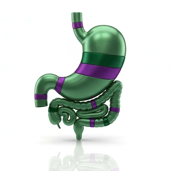 Gastrointestinal Surgery